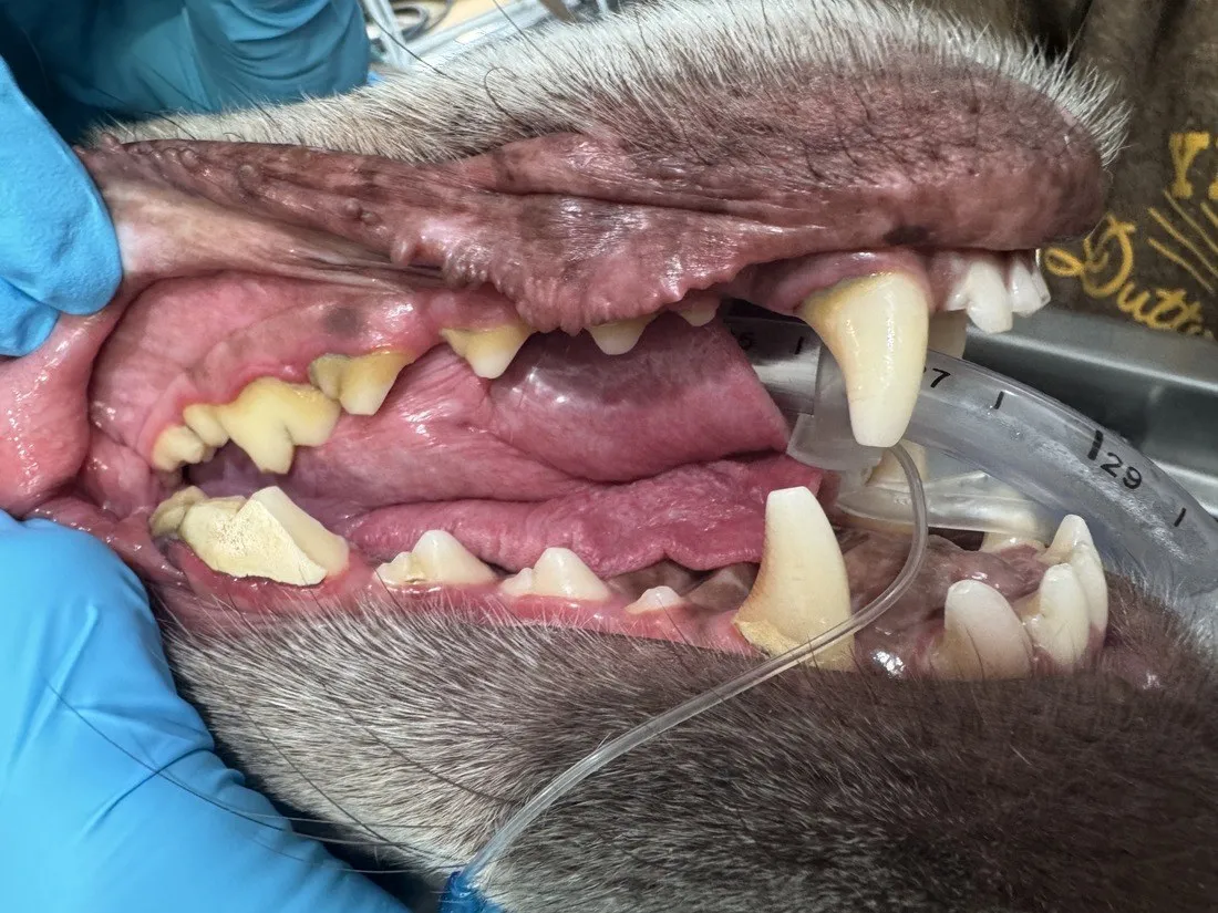 Tartar and gum disease found during a dental cleaning
