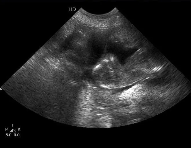 An ultrasound image on our monitor